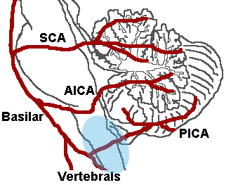 Cerebellar Arteries