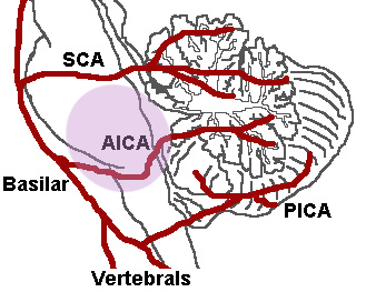 Cerebellar Arteries